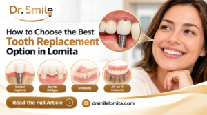 How to Choose the Best Tooth Replacement Option in Lomita
